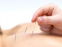 Acupuncture for Beginners